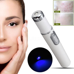 Hirundo Blue Light Beauty Skin Care Tool