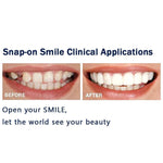 Magic Smile Teeth Brace