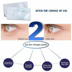 Anti-Wrinkle Eye Cream (10 pcs)